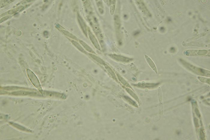 macrostoma