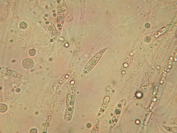 macrostoma