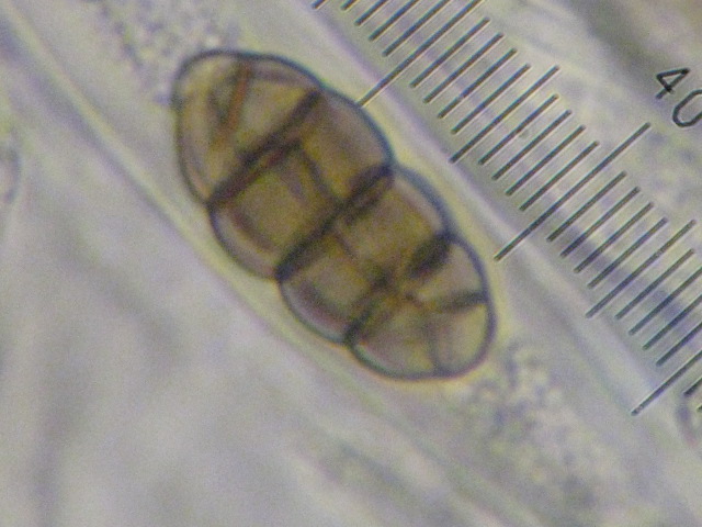 macrostoma