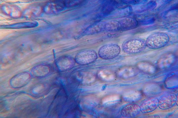 macrostoma