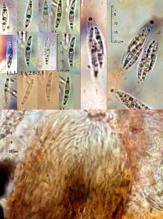 macrostoma