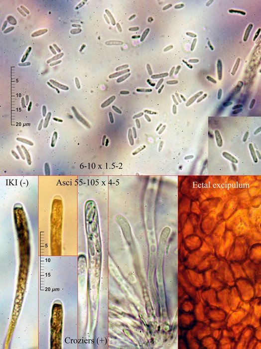 macrostoma