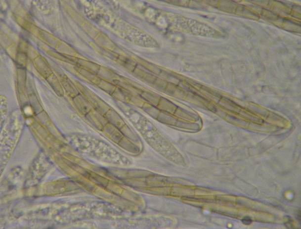 macrostoma