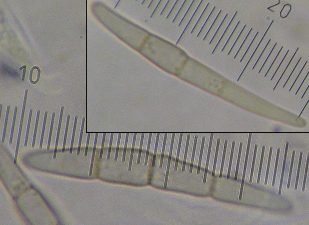 macrostoma