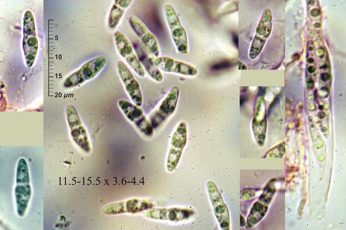 macrostoma