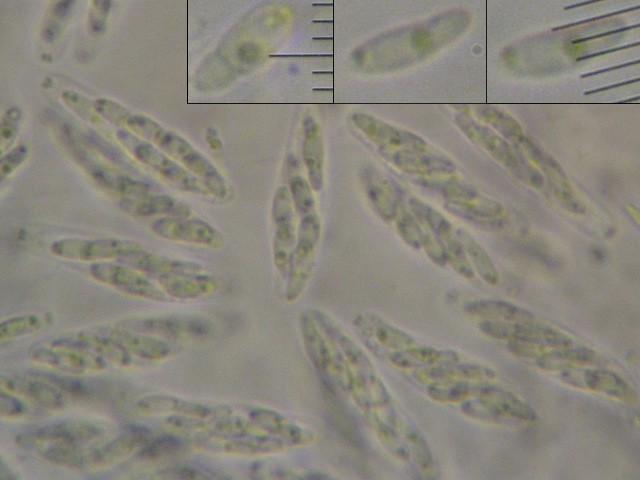 macrostoma