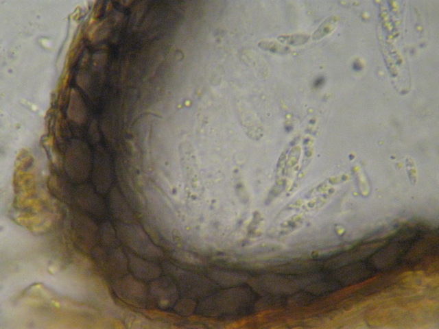 macrostoma