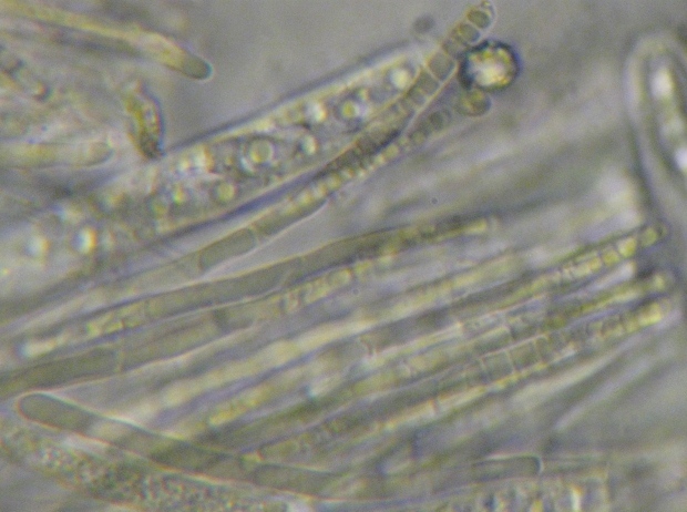 macrostoma