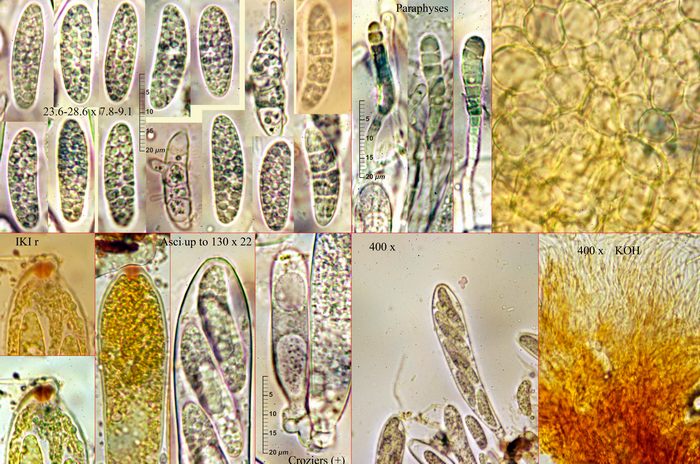 macrostoma