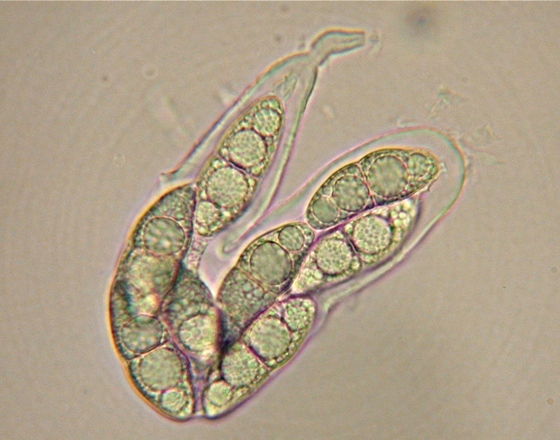 macrostoma