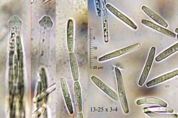 macrostoma