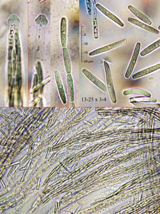 macrostoma