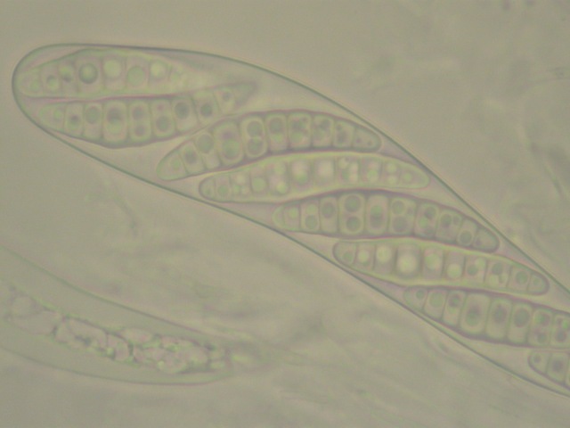 macrostoma