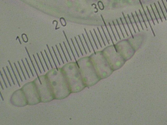 macrostoma