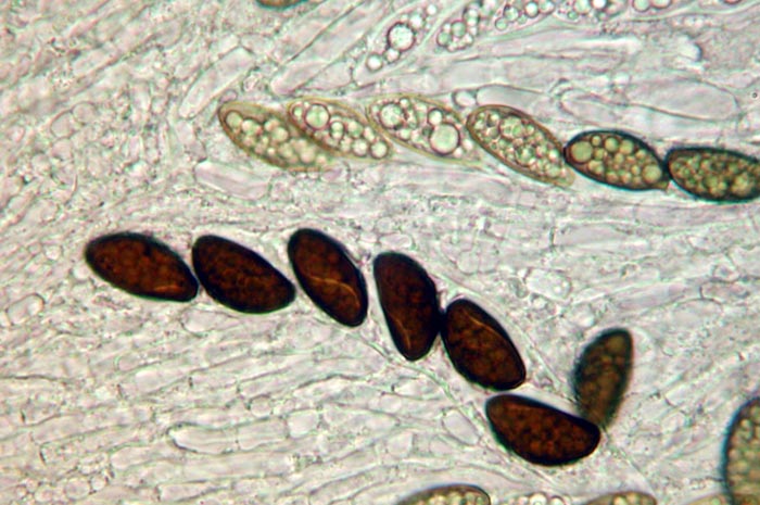 macrostoma