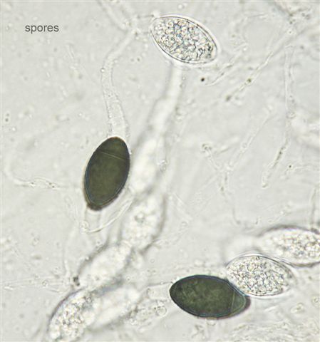 macrostoma