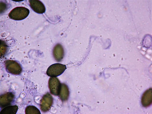 macrostoma