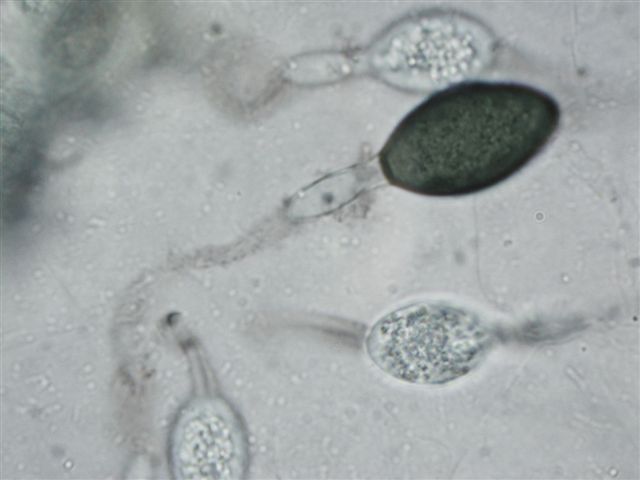 macrostoma