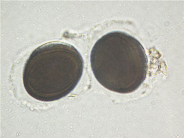 macrostoma