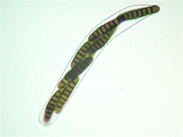 macrostoma