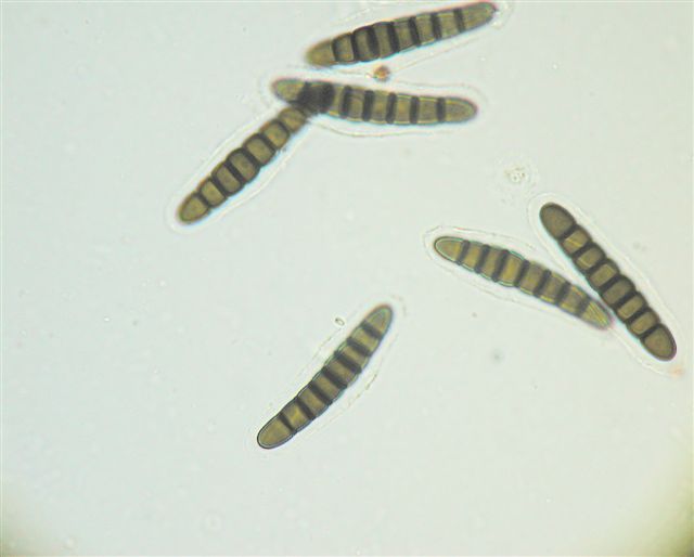 macrostoma