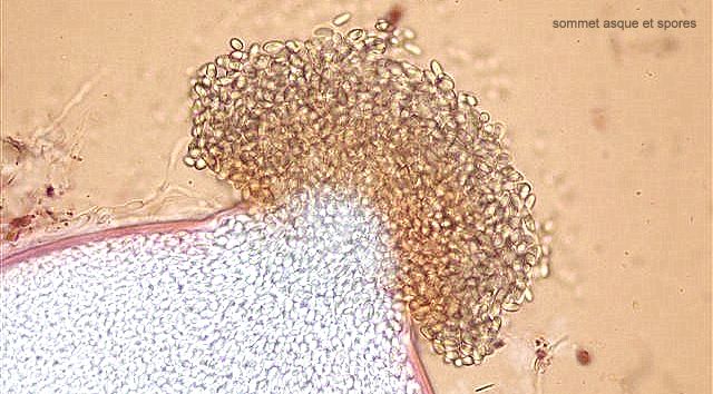 macrostoma