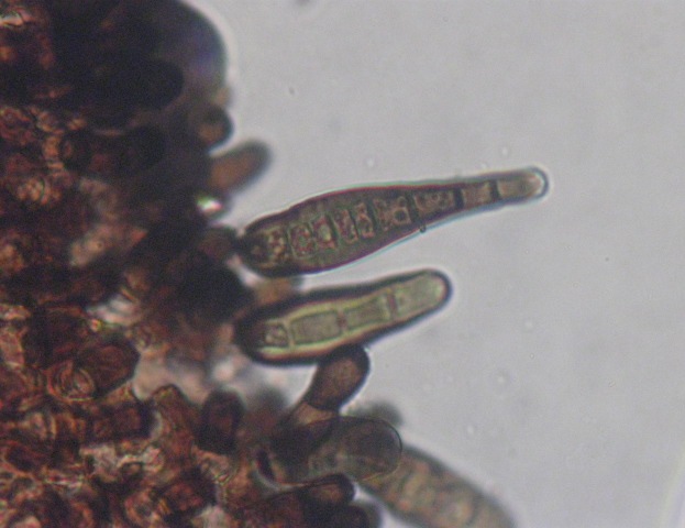 macrostoma