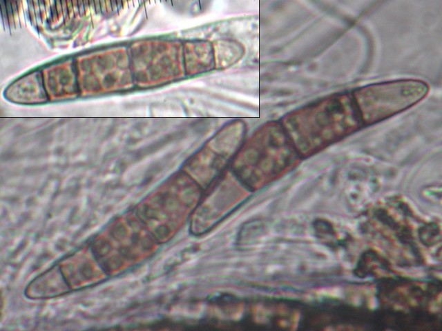 macrostoma