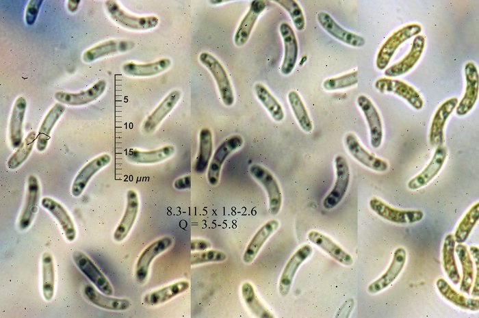macrostoma