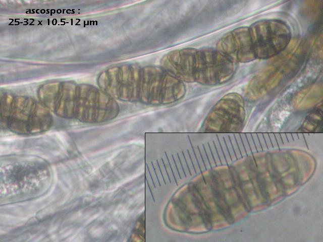 macrostoma