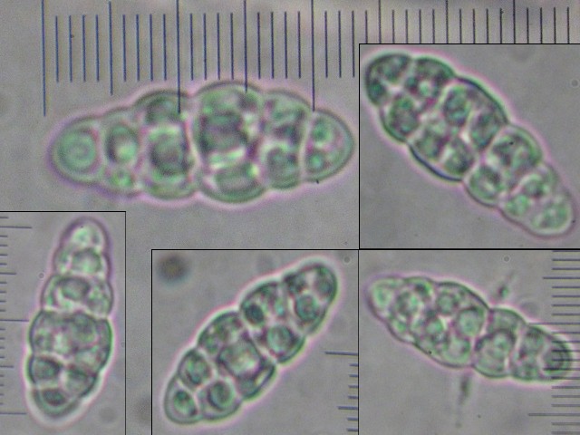 macrostoma