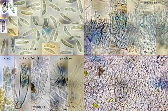 macrostoma