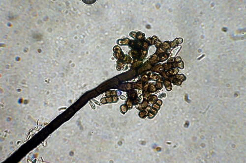macrostoma