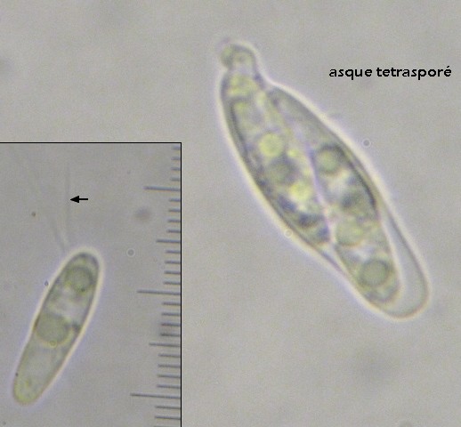 macrostoma
