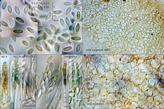 macrostoma