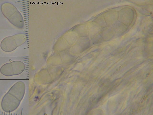 macrostoma
