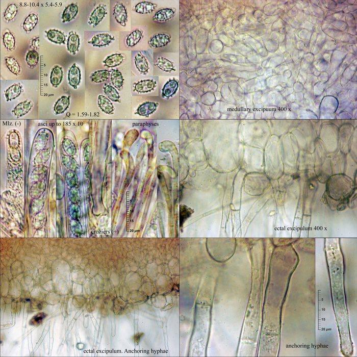 macrostoma