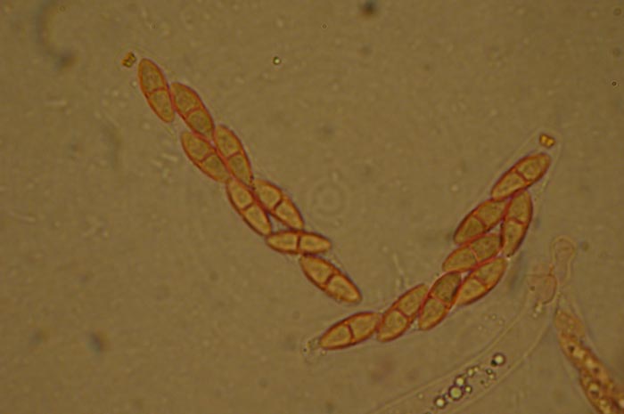 macrostoma