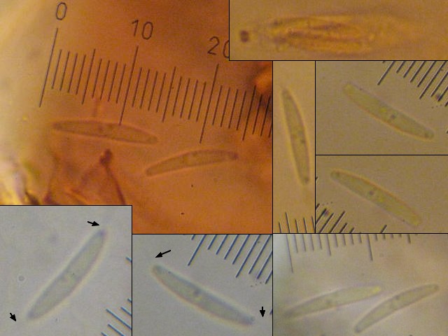 macrostoma