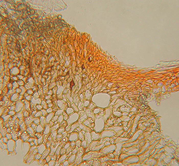 macrostoma