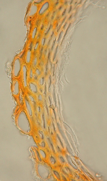 macrostoma