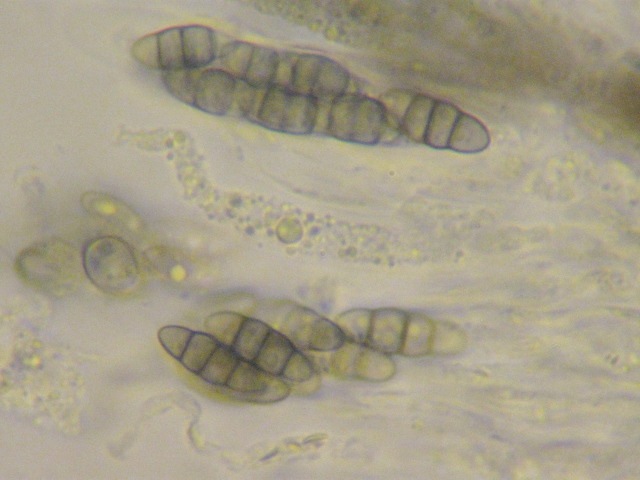macrostoma