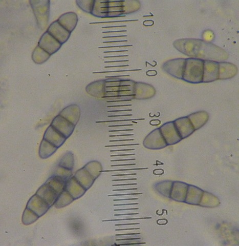 macrostoma
