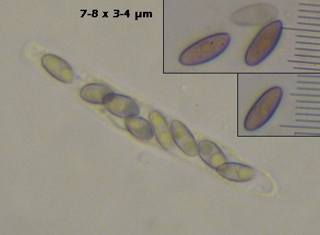 macrostoma
