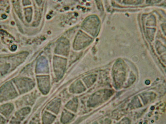 macrostoma