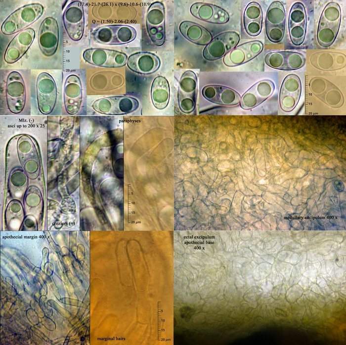 macrostoma