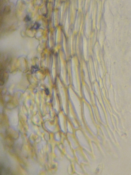 macrostoma