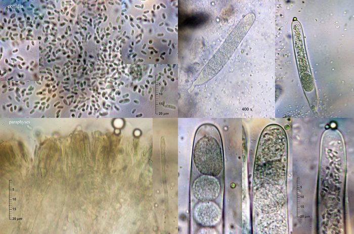 macrostoma
