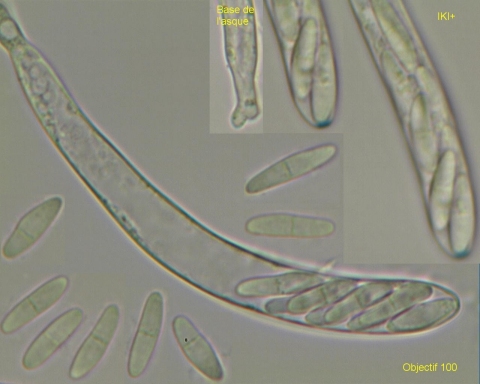 macrostoma