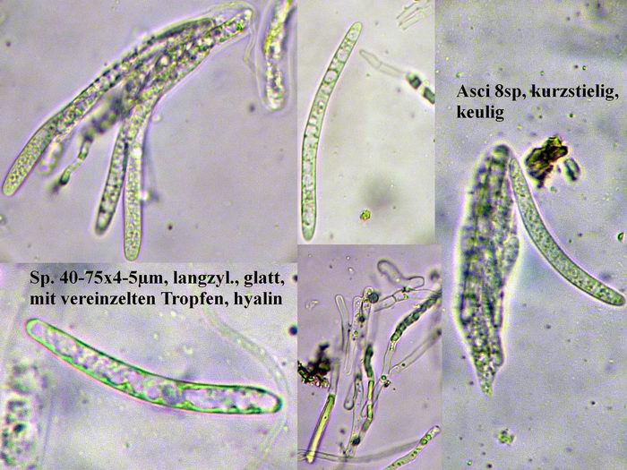 macrostoma